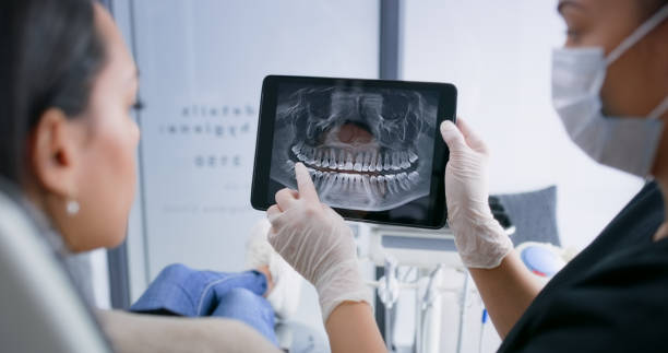 Licensed Wisdom Tooth Removal service in Tracy, CA - Smile Center Dentistry